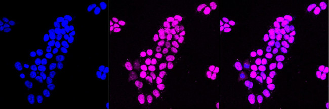 p27 Kip1 Antibody in Immunocytochemistry (ICC/IF)