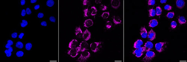 HK1 Antibody in Immunocytochemistry (ICC/IF)