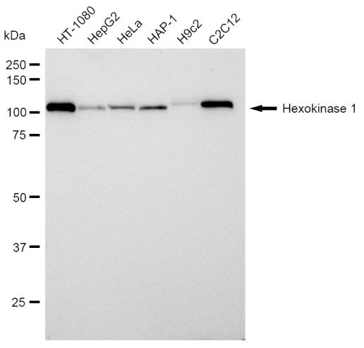 HK1 Antibody in Western Blot (WB)