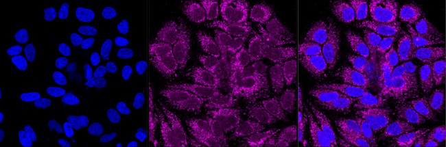 DLAT Antibody in Immunocytochemistry (ICC/IF)