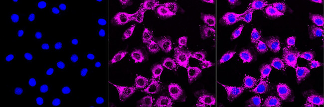 Fibronectin Antibody in Immunocytochemistry (ICC/IF)