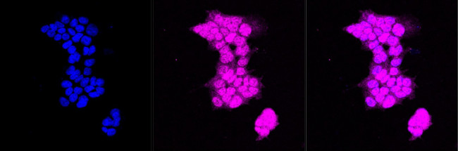 SMAD2 Antibody in Immunocytochemistry (ICC/IF)