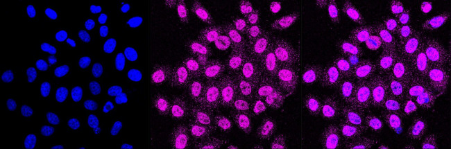 ERCC1 Antibody in Immunocytochemistry (ICC/IF)