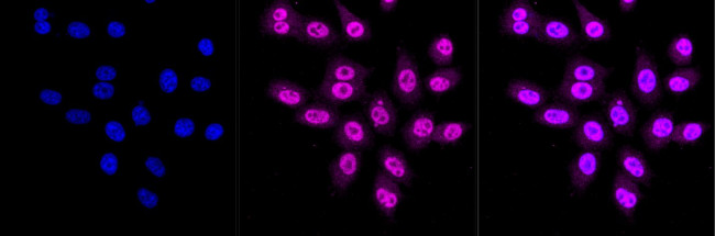 CRK Antibody in Immunocytochemistry (ICC/IF)