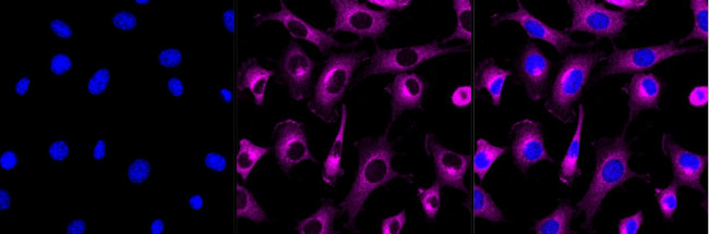 PKC alpha Antibody in Immunocytochemistry (ICC/IF)