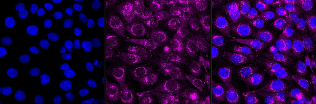 Amyloid Precursor Protein Antibody in Immunocytochemistry (ICC/IF)