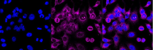 TSC2 Antibody in Immunocytochemistry (ICC/IF)