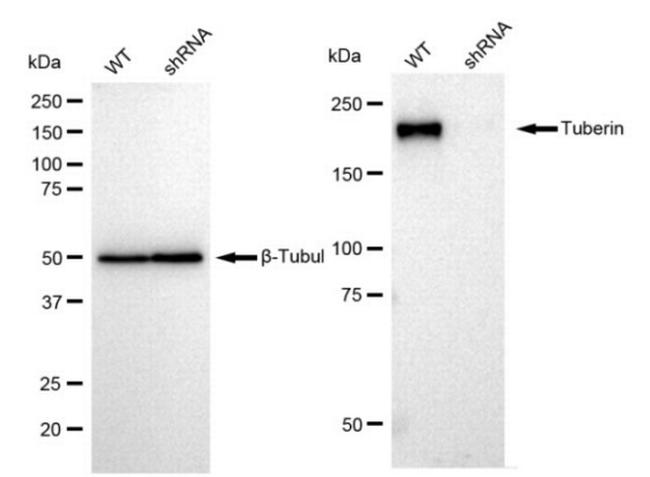 TSC2 Antibody