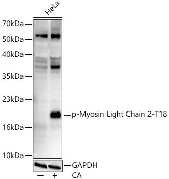 Phospho-MYL2 (Thr18) Antibody in Western Blot (WB)