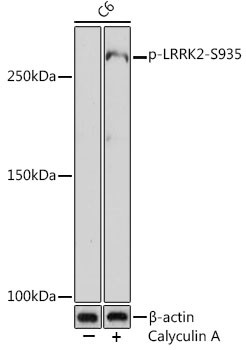 Phospho-LRRK2 (Ser935) Antibody in Western Blot (WB)