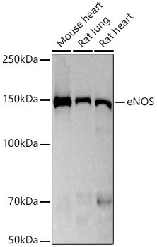 eNOS Antibody in Western Blot (WB)