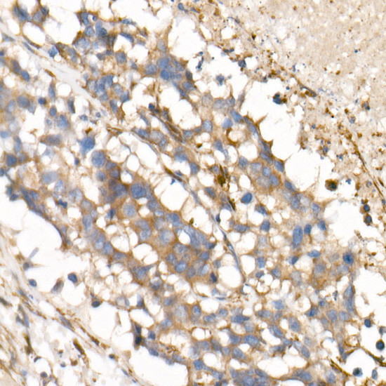 IL-15 Antibody in Immunohistochemistry (Paraffin) (IHC (P))