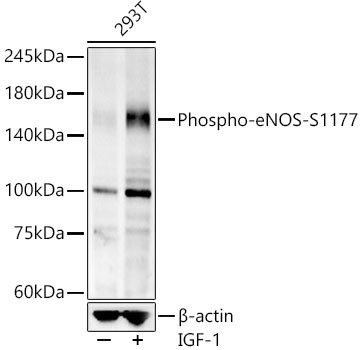 Phospho-eNOS (Ser1177) Antibody in Western Blot (WB)