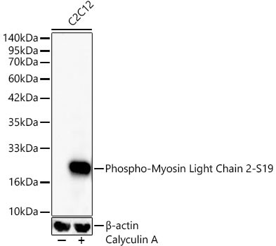 Phospho-MYL2 (Ser19) Antibody in Western Blot (WB)