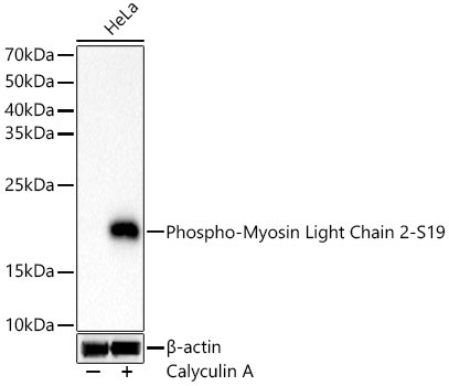 Phospho-MYL2 (Ser19) Antibody in Western Blot (WB)