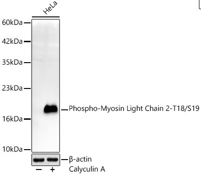 Phospho-MYL2 (Thr18, Ser19) Antibody in Western Blot (WB)