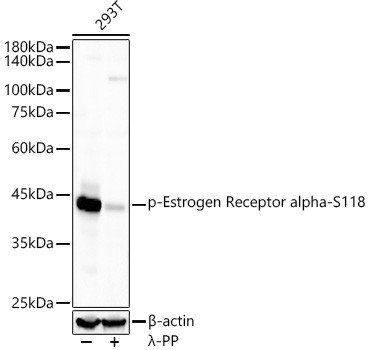 Phospho-PDHA1 (Ser293) Antibody in Western Blot (WB)