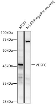 VEGFC Antibody in Western Blot (WB)