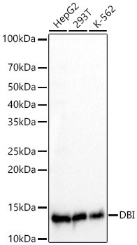 DBI Antibody in Western Blot (WB)