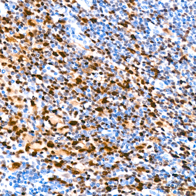 IRF4 Antibody in Immunohistochemistry (Paraffin) (IHC (P))