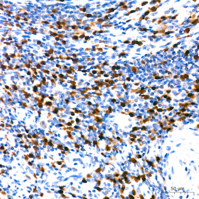 IRF4 Antibody in Immunohistochemistry (Paraffin) (IHC (P))