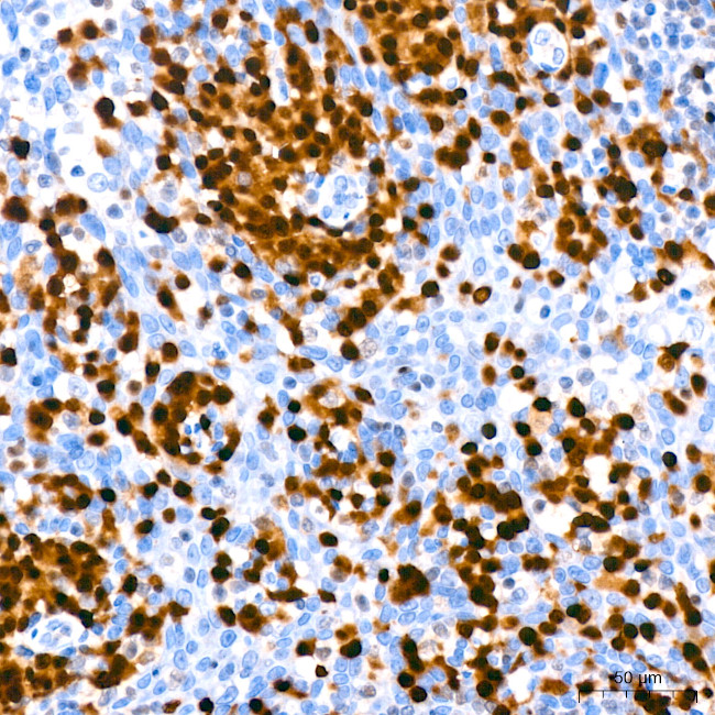 IRF4 Antibody in Immunohistochemistry (Paraffin) (IHC (P))