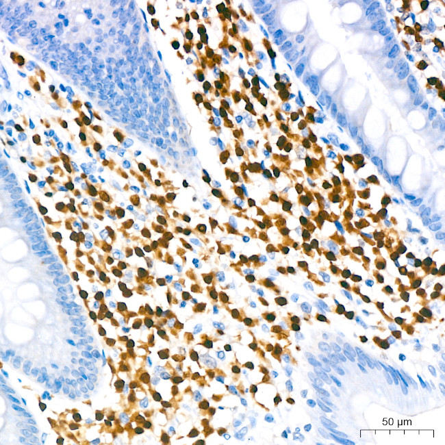 IRF4 Antibody in Immunohistochemistry (Paraffin) (IHC (P))