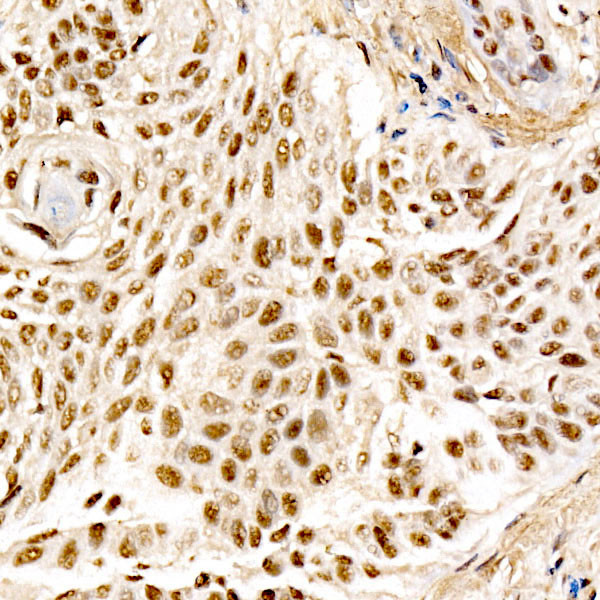 MDM2 Antibody in Immunohistochemistry (Paraffin) (IHC (P))