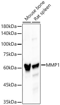 MMP1 Antibody in Western Blot (WB)