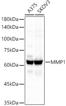 MMP1 Antibody in Western Blot (WB)