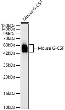 G-CSF Antibody in Western Blot (WB)