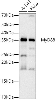 MyD88 Antibody in Western Blot (WB)