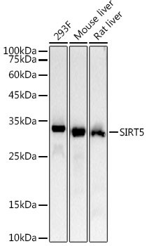 SIRT5 Antibody in Western Blot (WB)