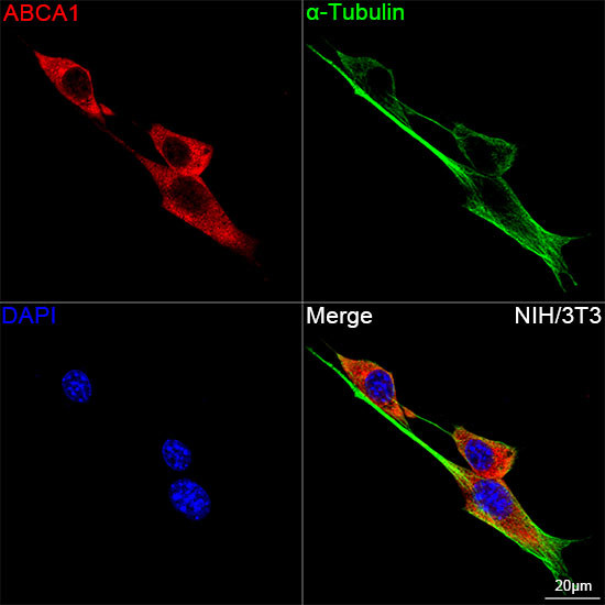 ABCA1 Antibody in Immunocytochemistry (ICC/IF)