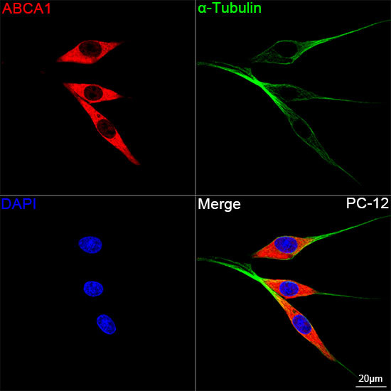 ABCA1 Antibody in Immunocytochemistry (ICC/IF)