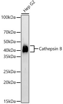 Cathepsin B Antibody in Western Blot (WB)