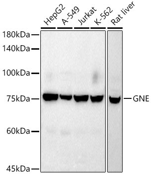 GNE Antibody in Western Blot (WB)