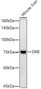 GNE Antibody in Western Blot (WB)