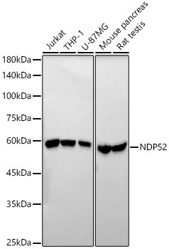 CALCOCO2 Antibody in Western Blot (WB)