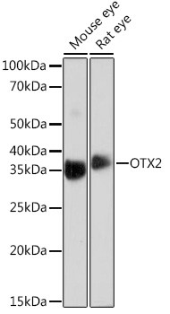 OTX2 Antibody in Western Blot (WB)