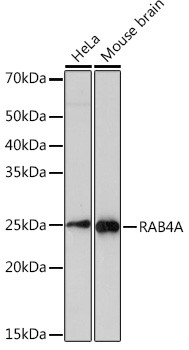 Rab4 Antibody in Western Blot (WB)