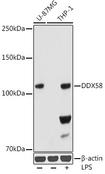 RIG-I Antibody in Western Blot (WB)