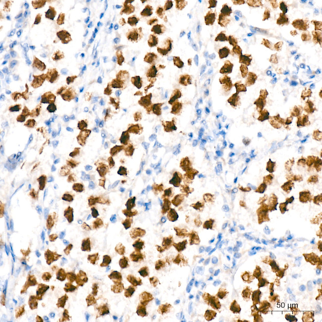 SALL4 Antibody in Immunohistochemistry (Paraffin) (IHC (P))