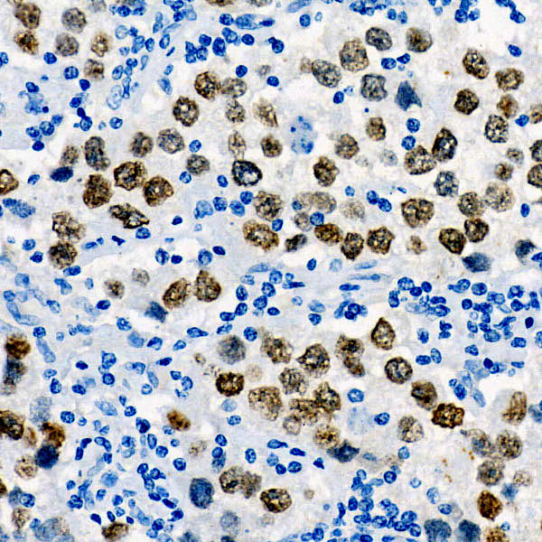 SALL4 Antibody in Immunohistochemistry (Paraffin) (IHC (P))