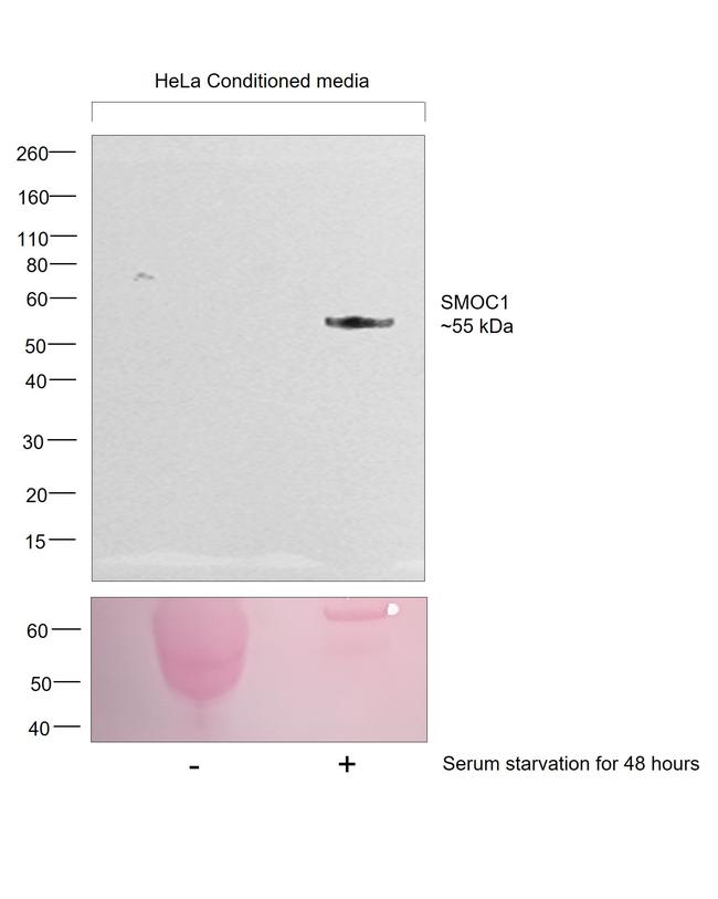 SMOC1 Antibody in Western Blot (WB)