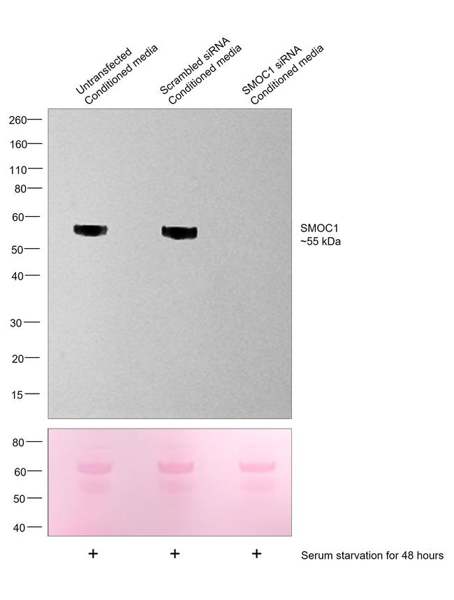 SMOC1 Antibody in Western Blot (WB)