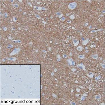 Synaptotagmin 1 Antibody in Immunohistochemistry (Paraffin) (IHC (P))