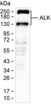 ALK Antibody in Western Blot (WB)