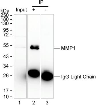 MMP1 Antibody in Immunoprecipitation (IP)