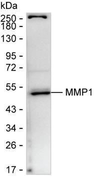 MMP1 Antibody in Western Blot (WB)